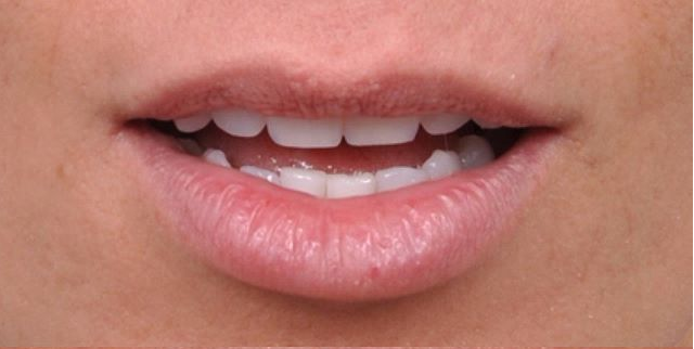 clipart-frame-shape2